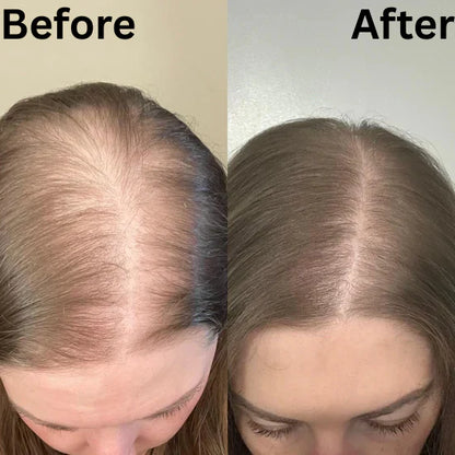 Solvana™ - Hair Growth Boost Chews